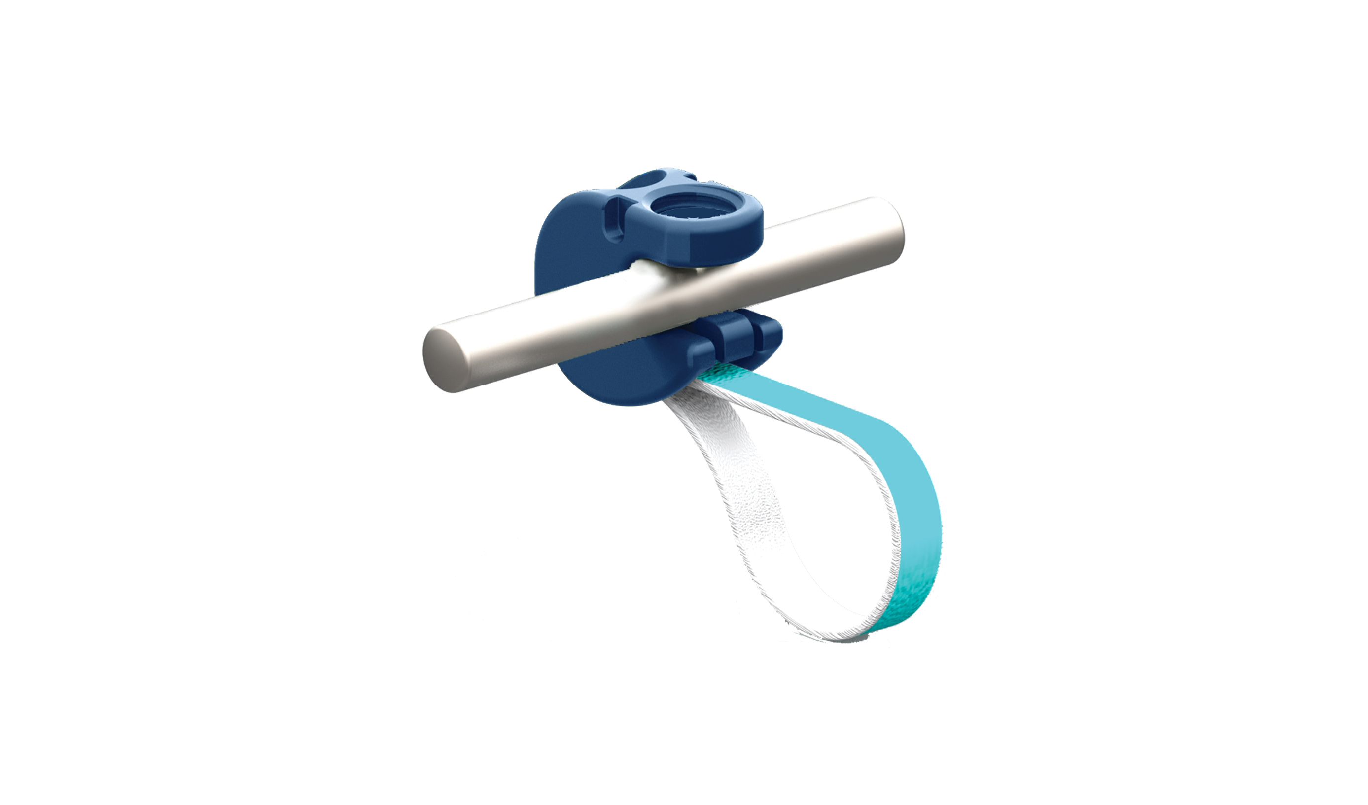 NILE Alternative Fixation | Stryker